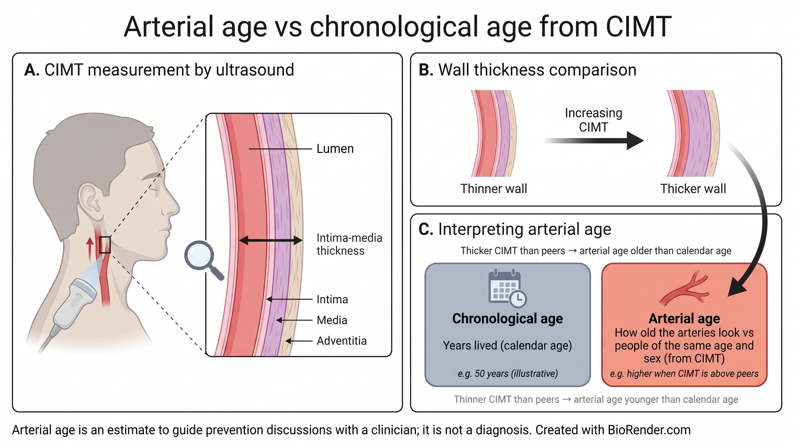 Scientific figure of arterial age versus chronological age from CIMT. Panel A: ultrasound on the neck with a carotid wall inset (lumen, intima, media, adventitia outermost; intima-media thickness on intima+media only). Panel B: thinner wall to thicker wall as CIMT increases. Panel C: same-person comparison cards — chronological age is years lived (calendar age); arterial age is how old the arteries look versus people of the same age and sex from CIMT. Thicker CIMT than peers means arterial age older than calendar age; thinner means younger. Arterial age is an estimate for prevention discussions, not a diagnosis.
