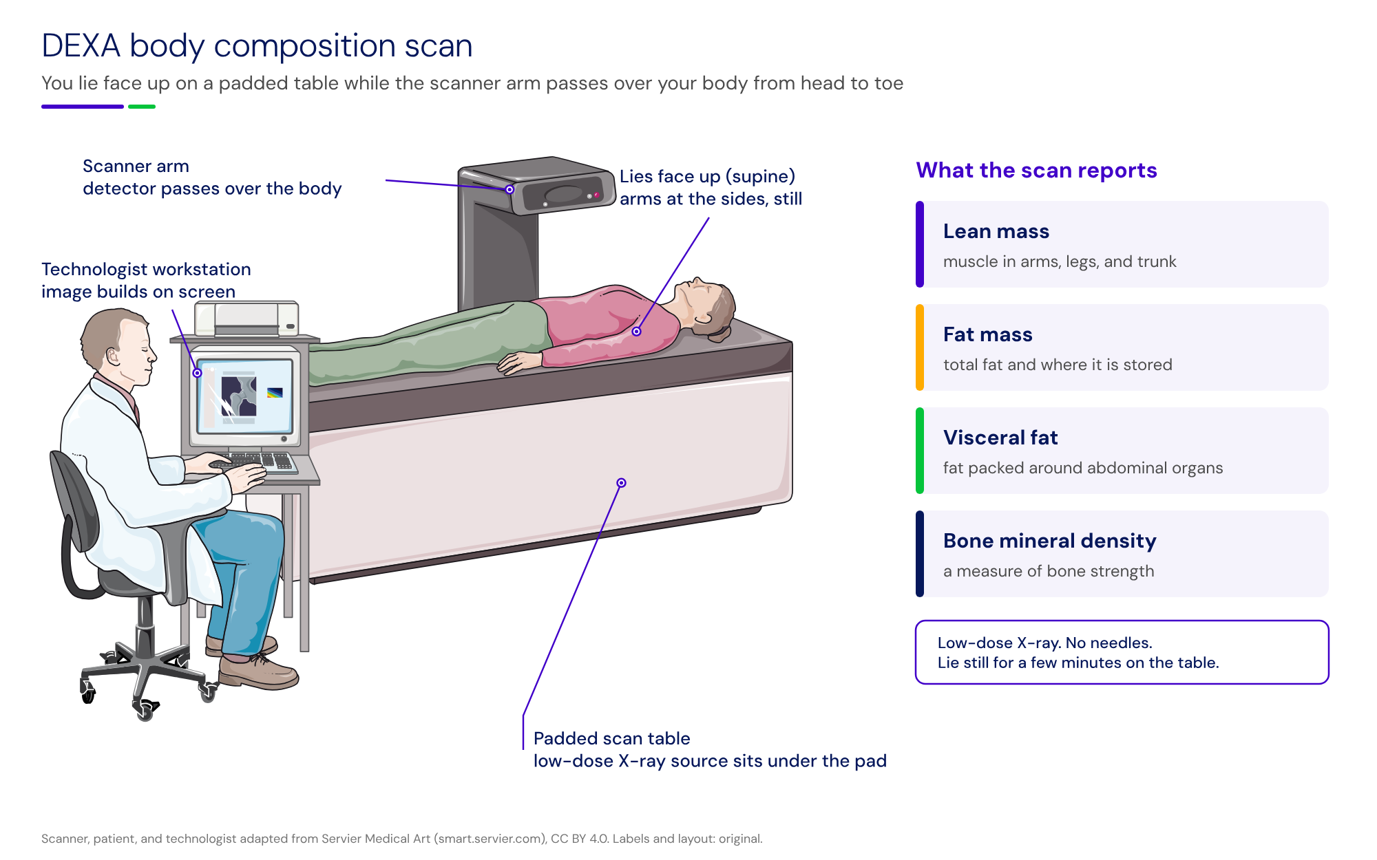 Illustrated DEXA body composition scan. A person lies face up on a padded DEXA table with arms at the sides while the scanner arm extends over the body, and a technologist at a workstation watches the scan image. Labels: scanner arm, lies face up (supine), technologist workstation, and padded scan table with the low-dose X-ray source under the pad. A side panel lists what the scan reports: lean mass, fat mass, visceral fat, and bone mineral density.