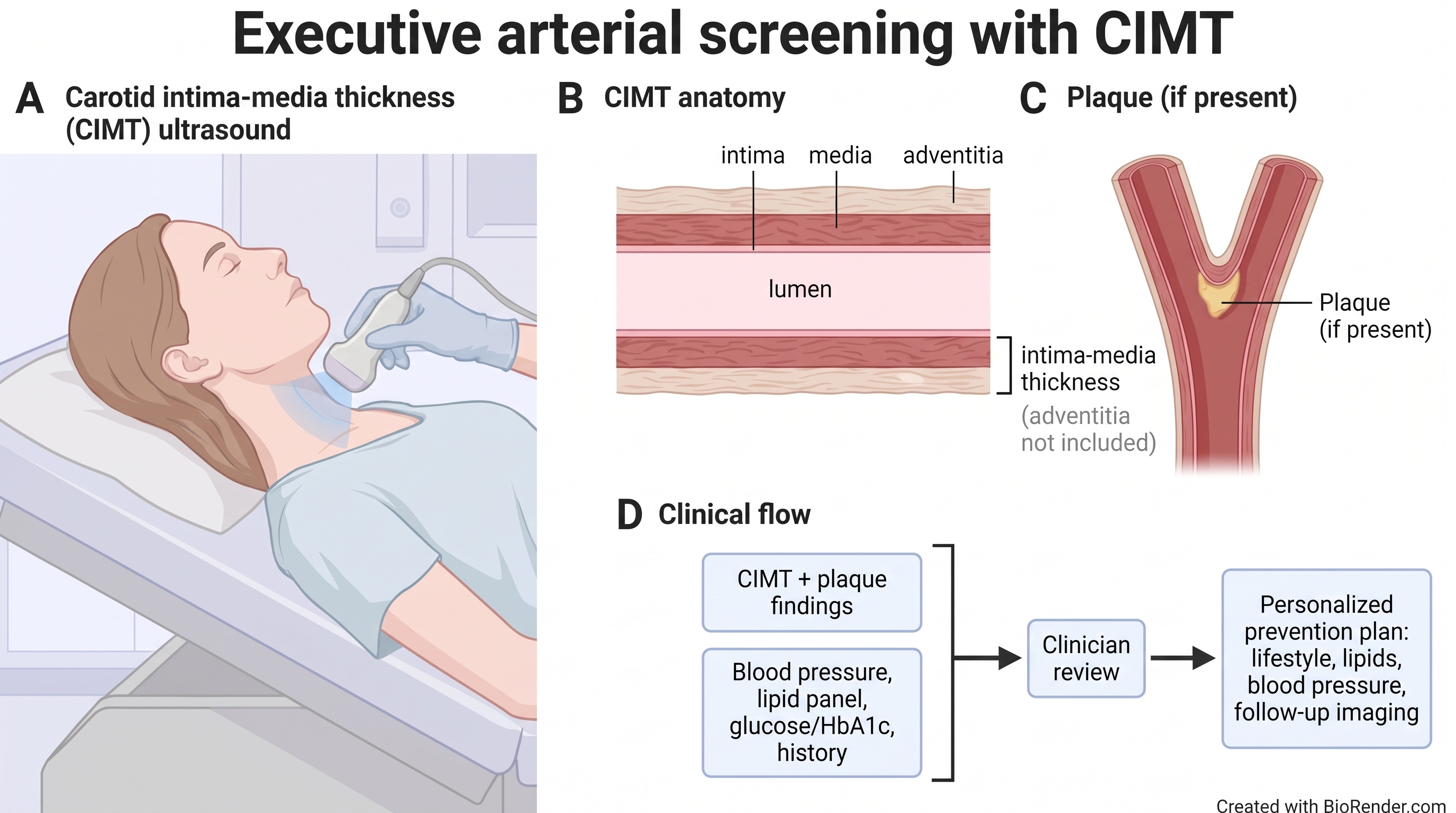 Scientific figure of executive arterial screening with CIMT. Panel A: carotid ultrasound probe on the neck. Panel B: vessel wall layers labeled lumen (inside), intima, media, and adventitia (outermost); intima-media thickness bracket spans intima and media only and excludes adventitia. Panel C: optional plaque at the carotid bifurcation. Panel D: CIMT plus plaque findings and labs flow to clinician review, then a personalized prevention plan.